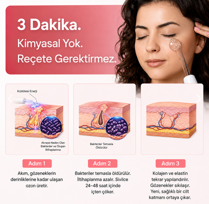 Veloura™  Yüksek frekanslı değnek