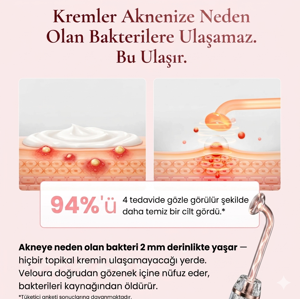 Veloura™  Yüksek frekanslı değnek