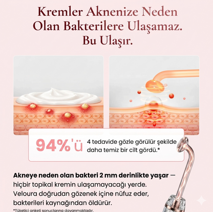 Veloura™  Yüksek frekanslı değnek